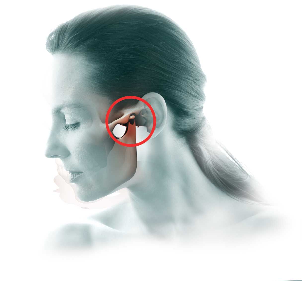 TMJ Disorder Chiropractic Care